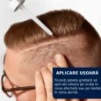 Aplicare usoara solutie minoxidil