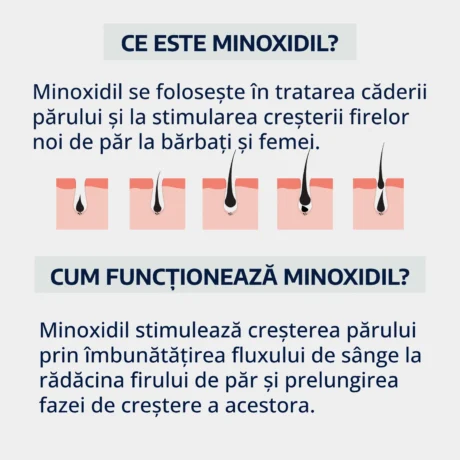 Ce este Minoxidil? Cum functioneaza minoxidil?