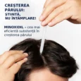 Cresterea parului minoxidil