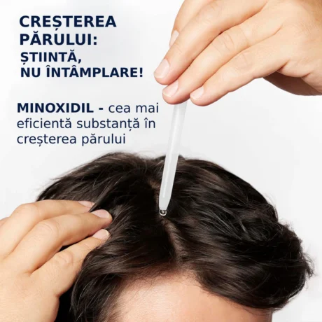 Cresterea parului minoxidil