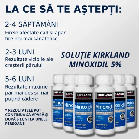 La ce sa te astepti de la solutie minoxidil Kirkland 5%